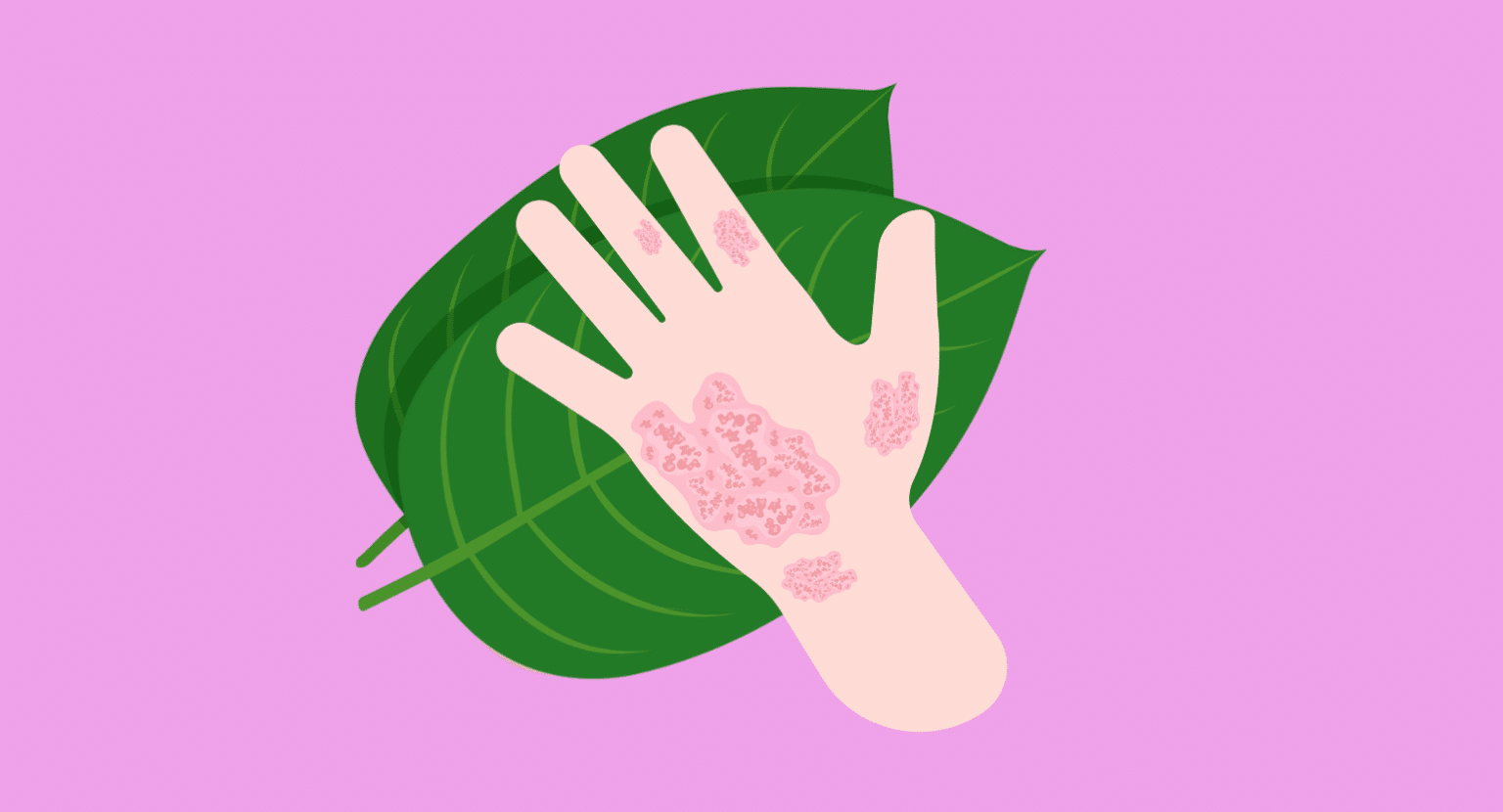 Can Kratom Make You Itchy? Maybe — But It's Complicated